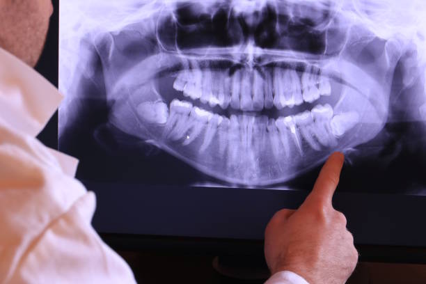 Best Cracked Tooth Emergency Dentist  in Mpo, CA