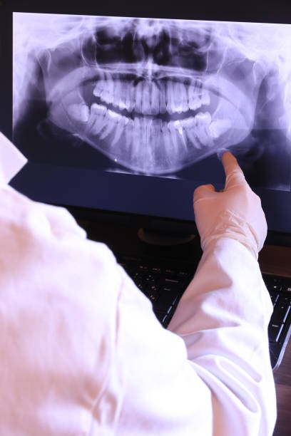 Best Knocked-Out Tooth Emergency  in Mpo, CA