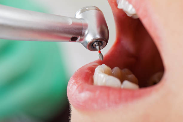 Best Dental Emergency Near Me  in Mpo, CA
